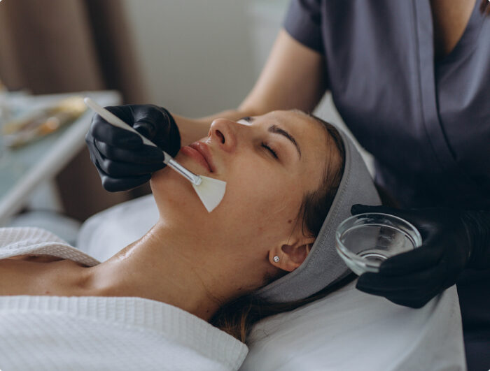 Chemical Peels
